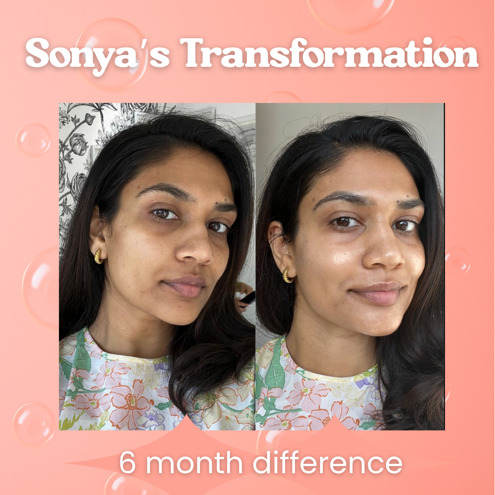 CtrlGirl™ Liposomal Glutathione Drops