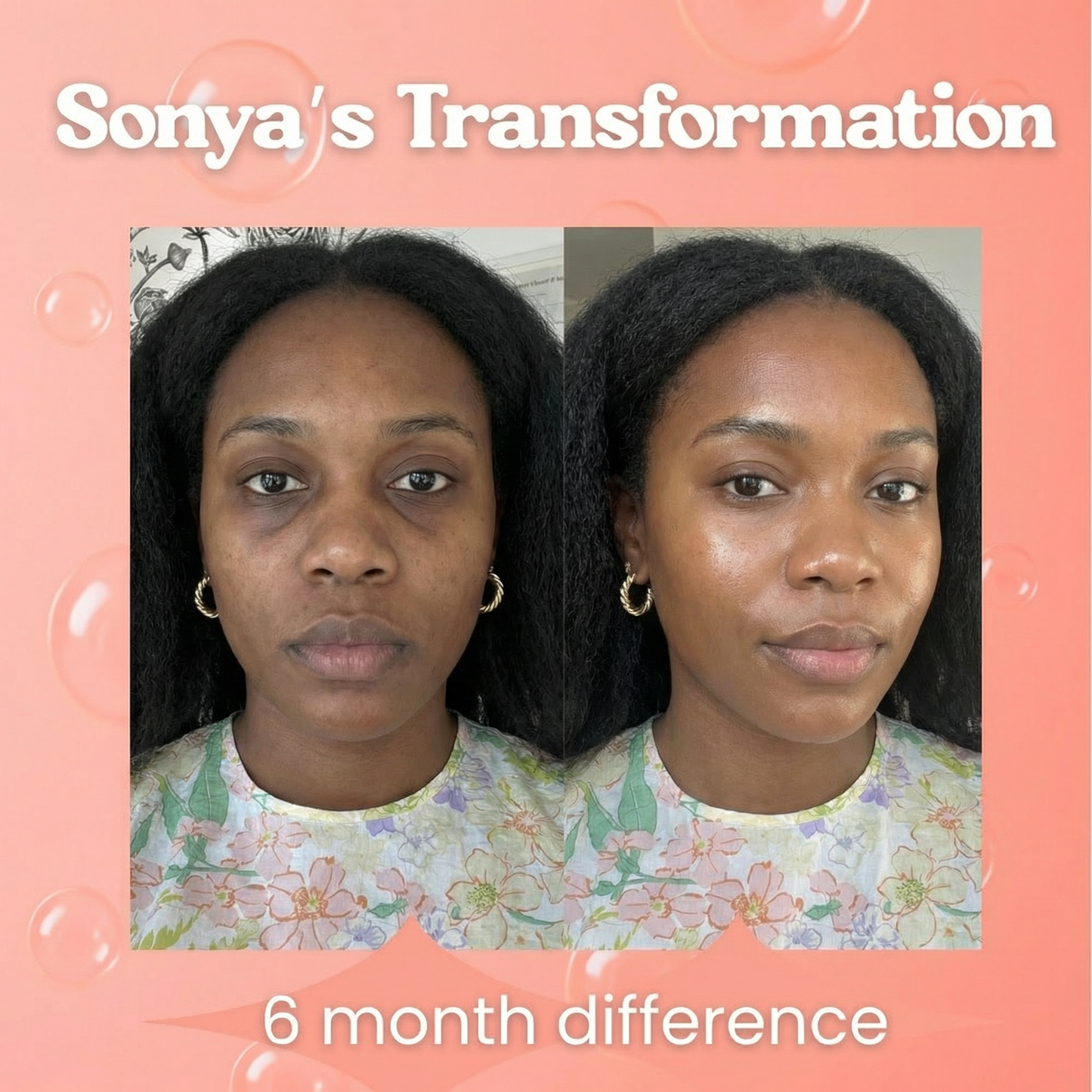 CtrlGirl™ Lipo Gluta Drops